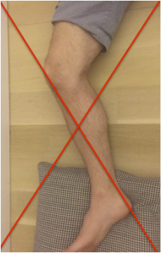incorrect knee extension stretch